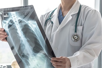 Doctor looking at x-ray of chest